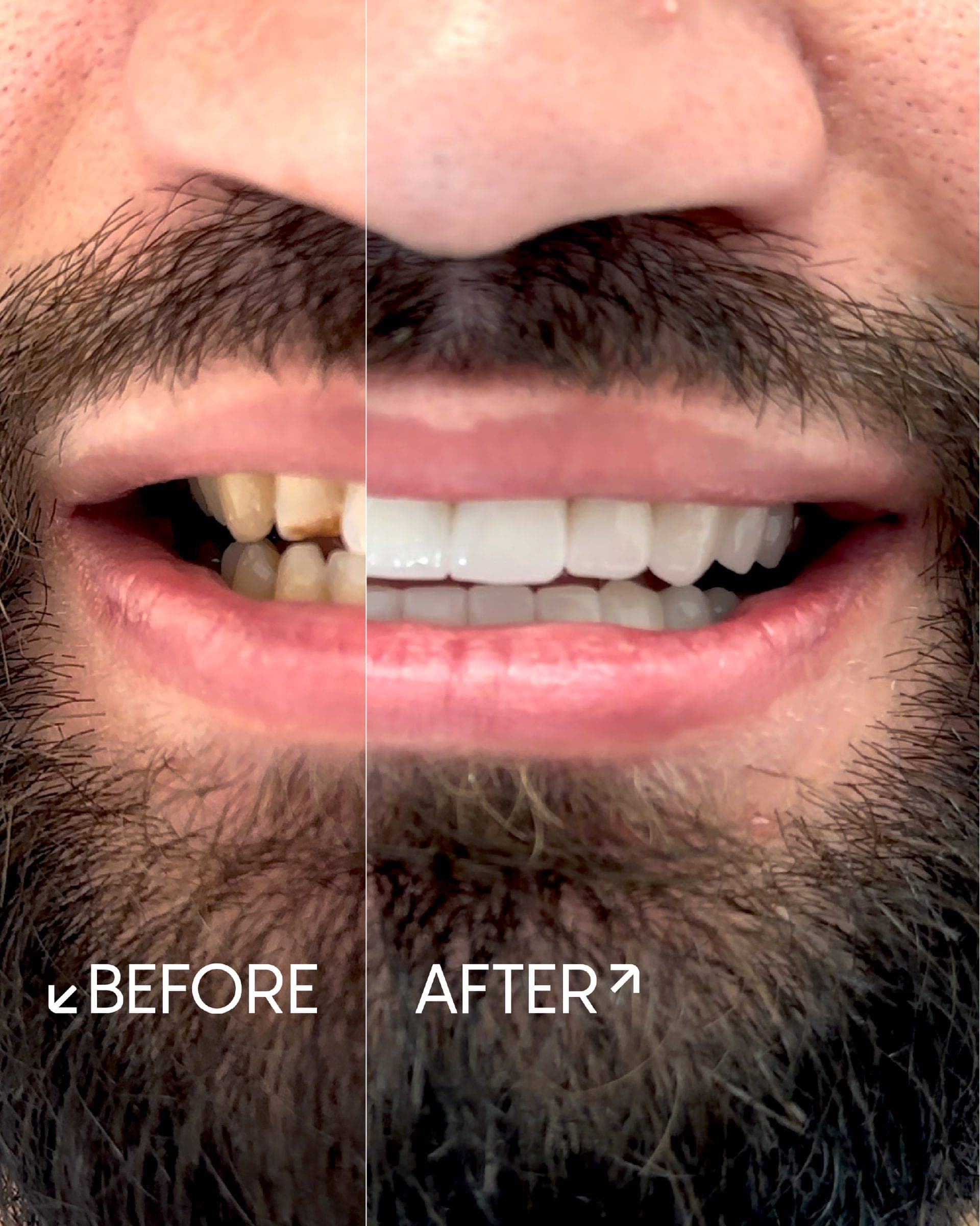 Marco's result, after