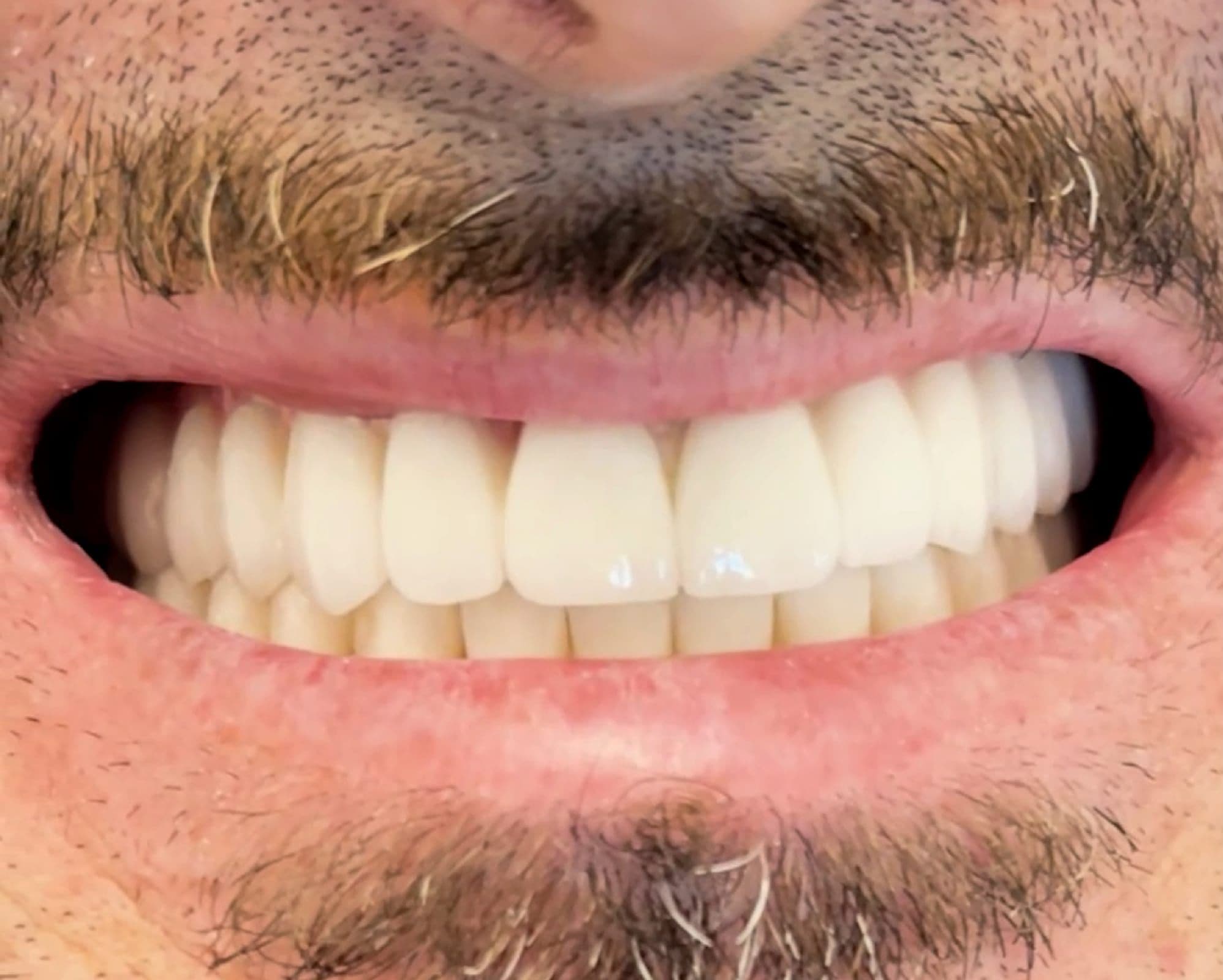 Nikos's result, after