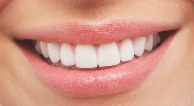 Creating a Smile