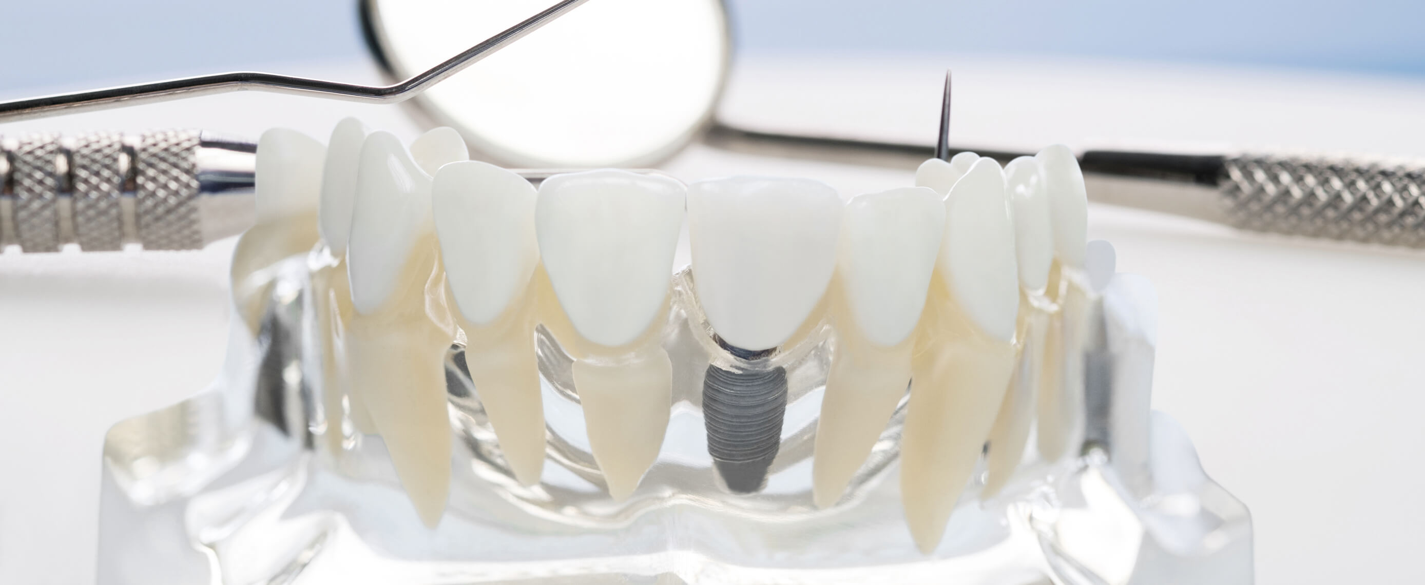 Dental Insights and Updates
